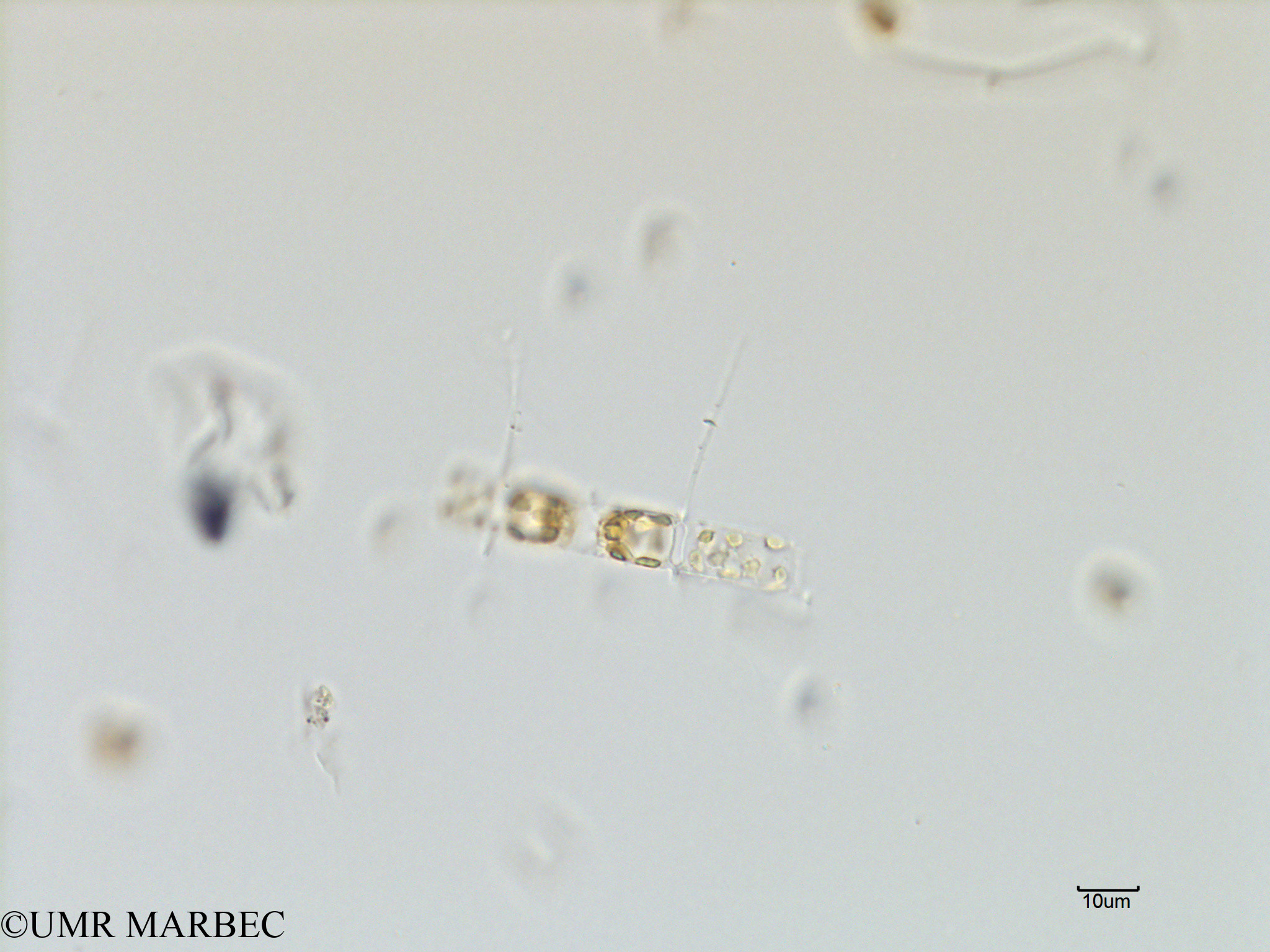 phyto/Scattered_Islands/mayotte_lagoon/SIREME May 2016/Chaetoceros sp8 (MAY3_chaetoceros_4-1).tif(copy).jpg